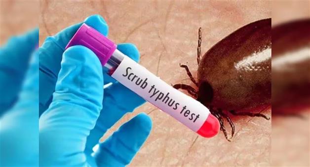 Khabar Odisha:1-more-died-in-scrub-typhus