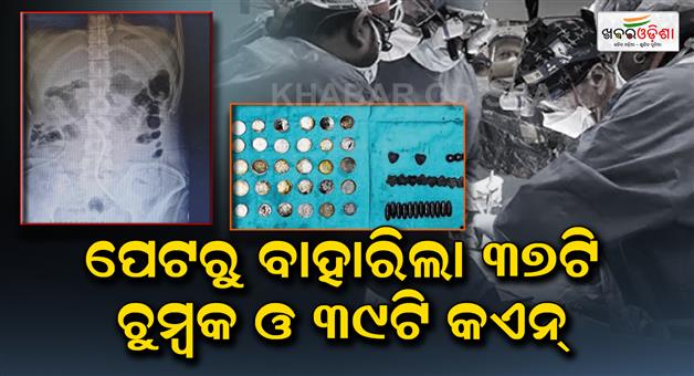 Khabar Odisha:37-magnets-and-39-coin-came-out-of-the-stomach