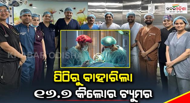 Khabar Odisha:A-167-kg-tumor-came-out-of-the-back