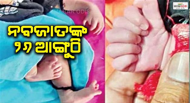 Khabar Odisha:A-baby-girl-with-26-fingers