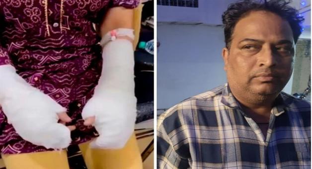 Khabar Odisha:Acid-attack-case-on-student-turns-out-to-be-fake-victims-father-confesses