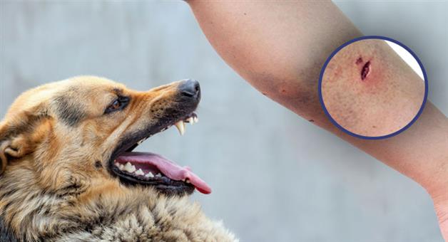 Khabar Odisha:Health-Tips-After-a-dog-bite-Improper-treatment-delayed-treatment-can-be-fatal