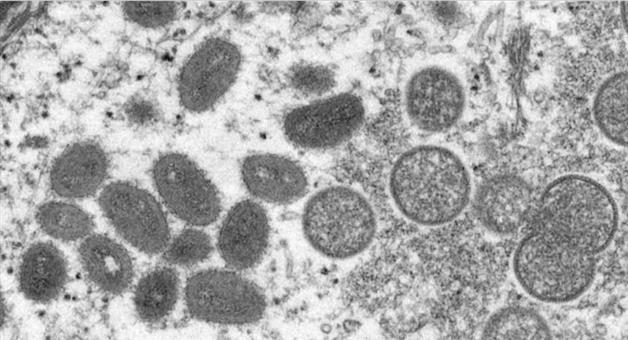 Khabar Odisha:International-Monkey-pox-global-emergency-virus-attack-first-time-in-68-countries