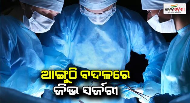 Khabar Odisha:Kerala-Doctor-Performed-Surgery-On-Tongue-Of-The-4-year-Old-Girl-Instead-Of-Her-Finger