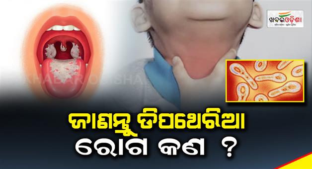 Khabar Odisha:Know-what-is-diphtheria