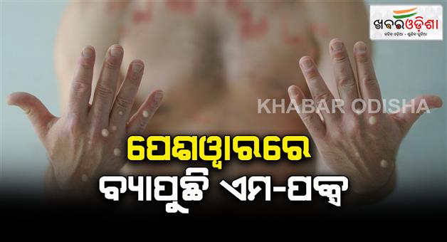 Khabar Odisha:M-pox-infection-scare-Another-infected-person-detected-in-Pakistan