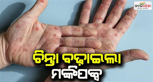 Khabar Odisha:Monkeypox-Fear