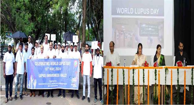 Khabar Odisha:SUM-Hospital-organizes-awareness-program-on-World-Lupus-Day