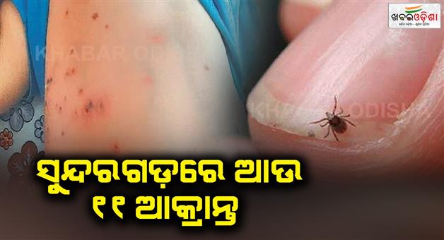 Khabar Odisha:The-number-of-scrub-typhus-cases-is-increasing-in-Sundargarh