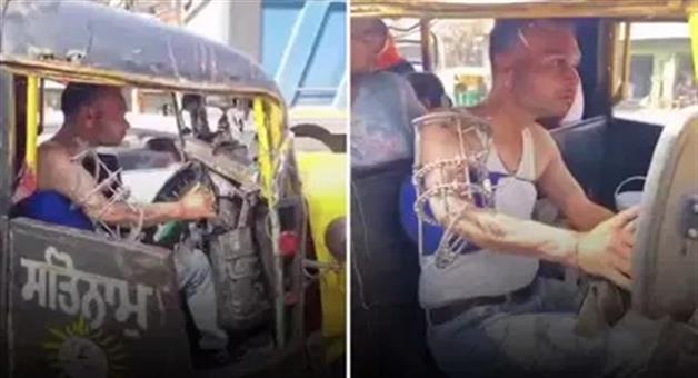 Khabar Odisha:Viral-Video-Shows-Despite-Fractured-Arm-With-Rod-Inserted-Man-Drives-Auto