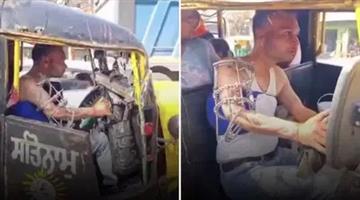 Khabar Odisha:Viral-Video-Shows-Despite-Fractured-Arm-With-Rod-Inserted-Man-Drives-Auto