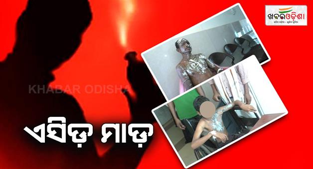 Khabar Odisha:acid-attack-on-father-and-son-in-kandhamal