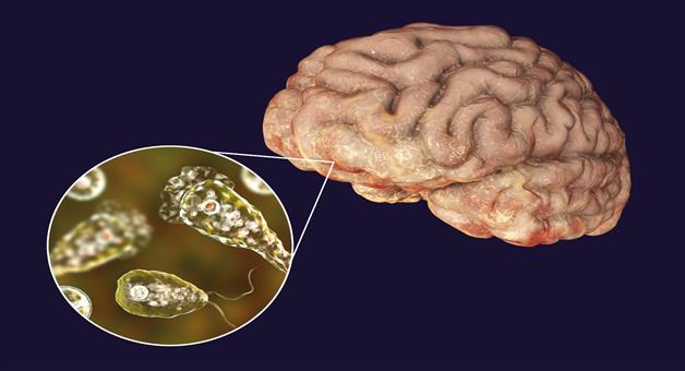 Khabar Odisha:again-brain-eating-amoeba-takes-another-life-in-kerala