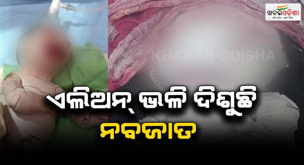 Khabar Odisha:alien-like-baby-born-in-madhya-pradesh