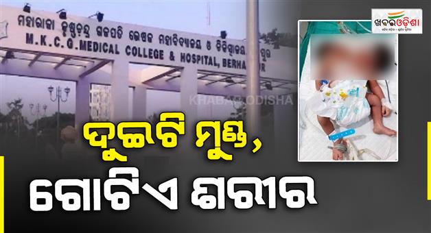 Khabar Odisha:berhampur-mkcg-rare-two-headed-baby