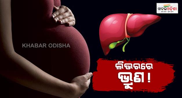 Khabar Odisha:foetus-grows-in-liver-of-a-woman