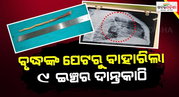 Khabar Odisha:old-man-swallowed-toothbrush-out-of-carelessness