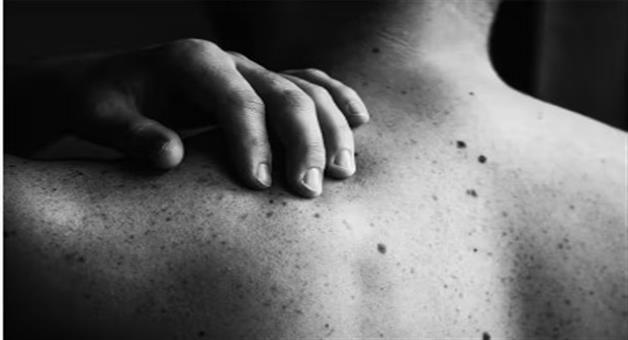 Khabar Odisha:why-do-many-moles-appear-on-the-body-and-what-are-the-medical-reasons-behind-them